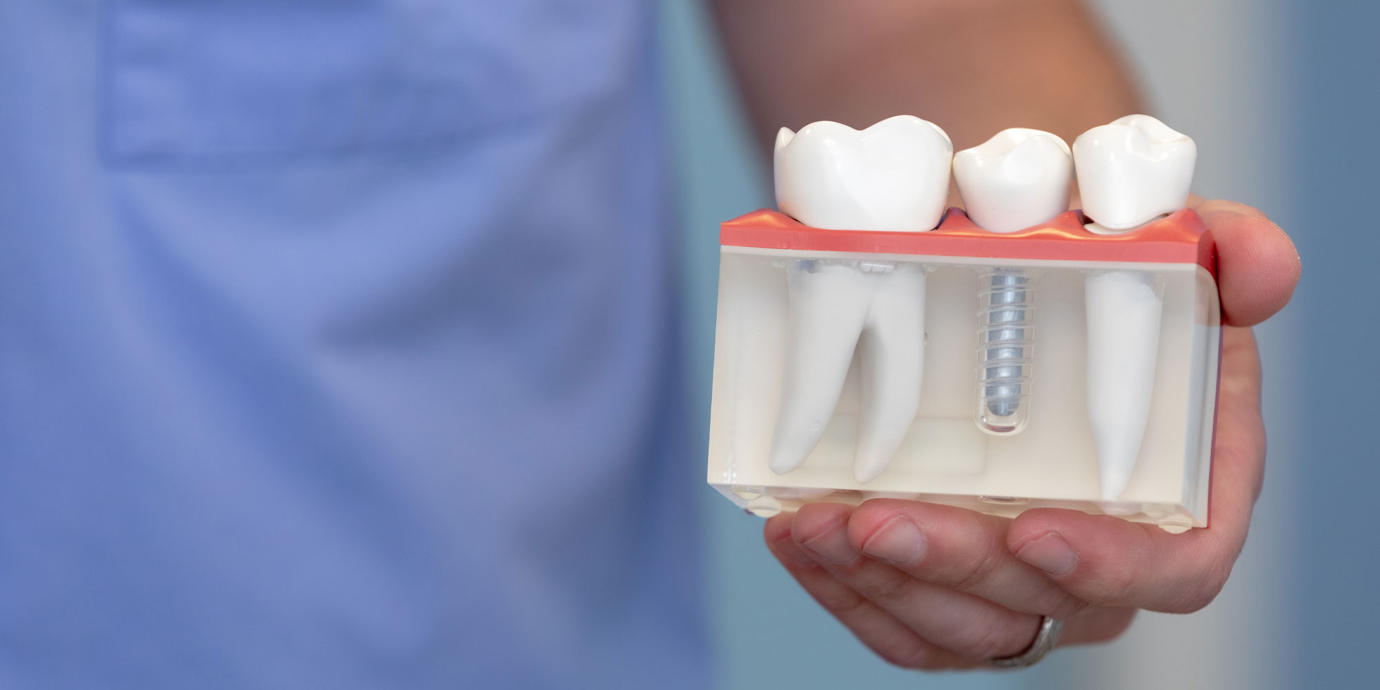 Not Sure If You Are A Candidate For Dental Implants In East Lansing, MI? We Can Help You Figure That Out